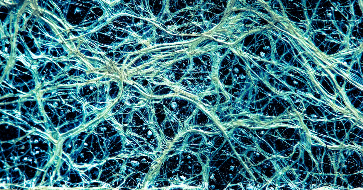 Fine vascular root network in plants. Fine vascular root network in plants.