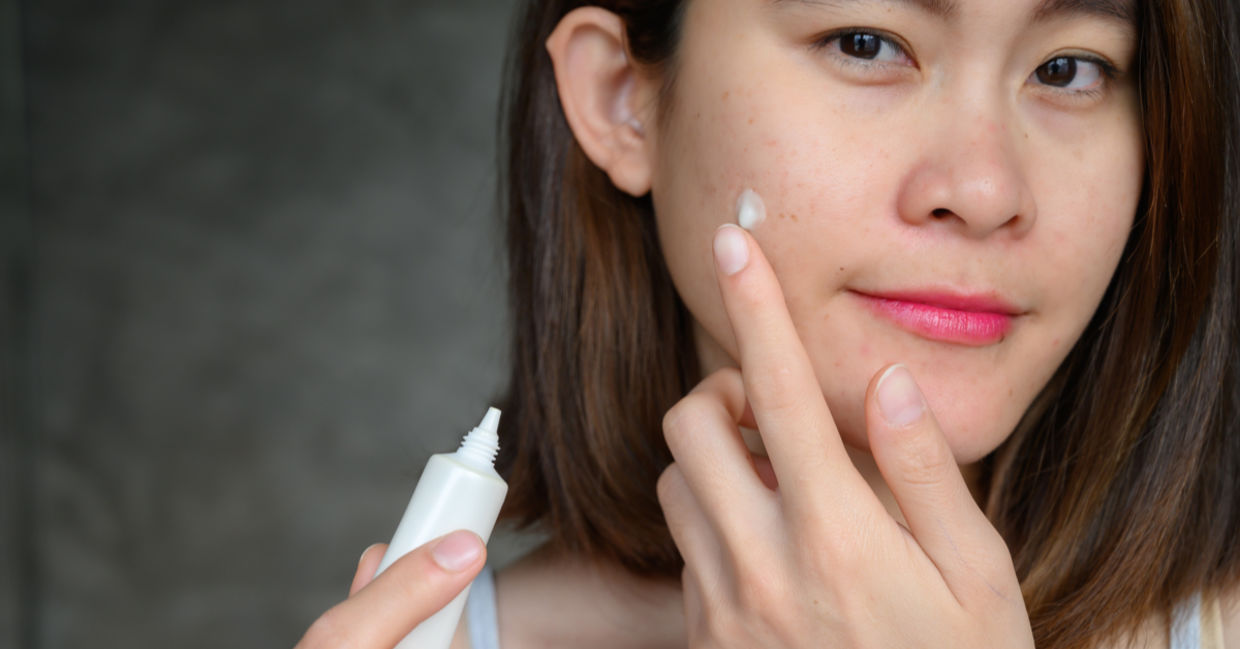 Treating a breakout with a tea tree oil cream. Treating a breakout with a tea tree oil cream.