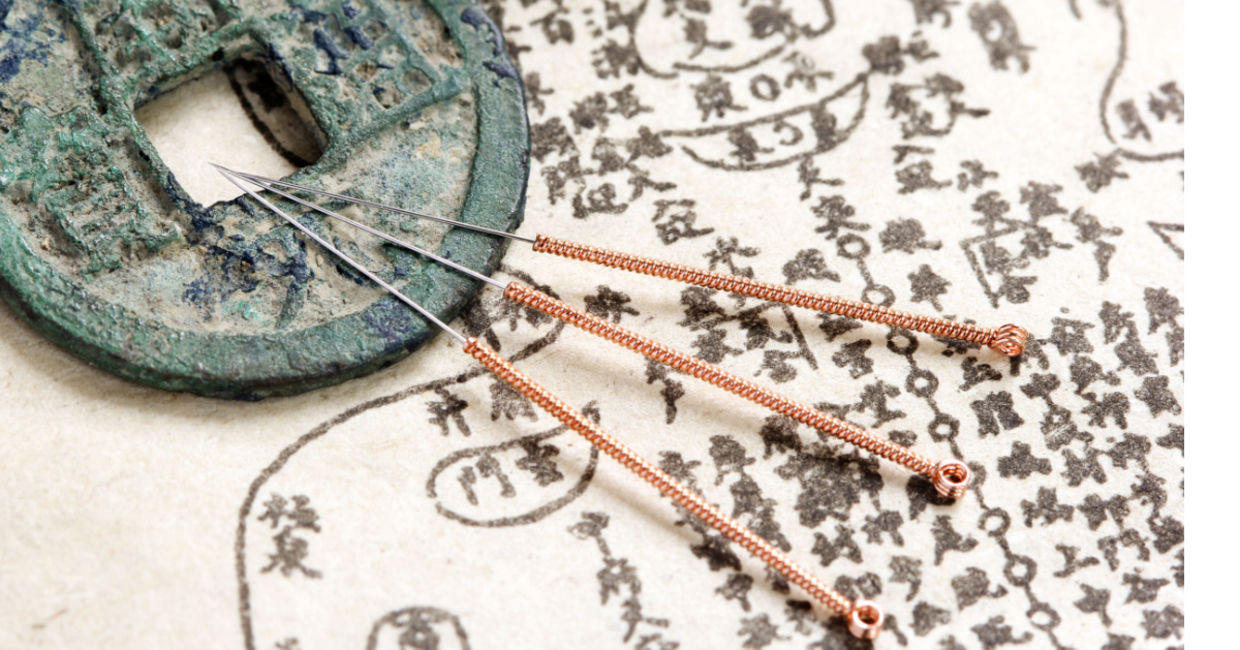 Acupuncture needles and text. Acupuncture needles and text.