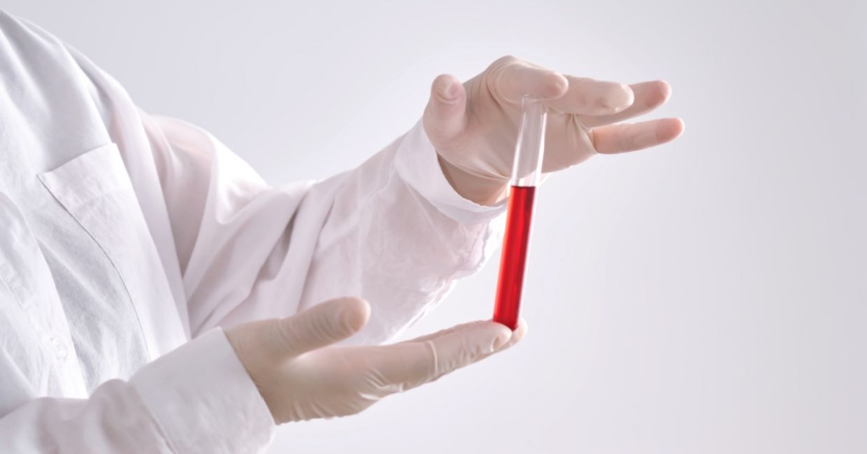 A new blood test detects Alzheimer's earlier.